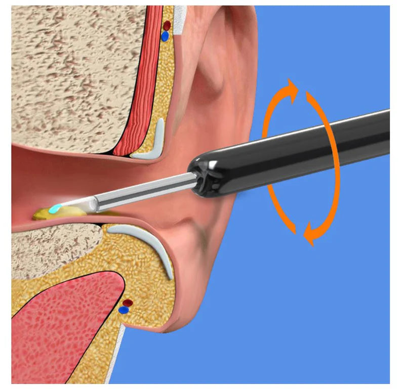 Earwax Removal Kit(free shipping)